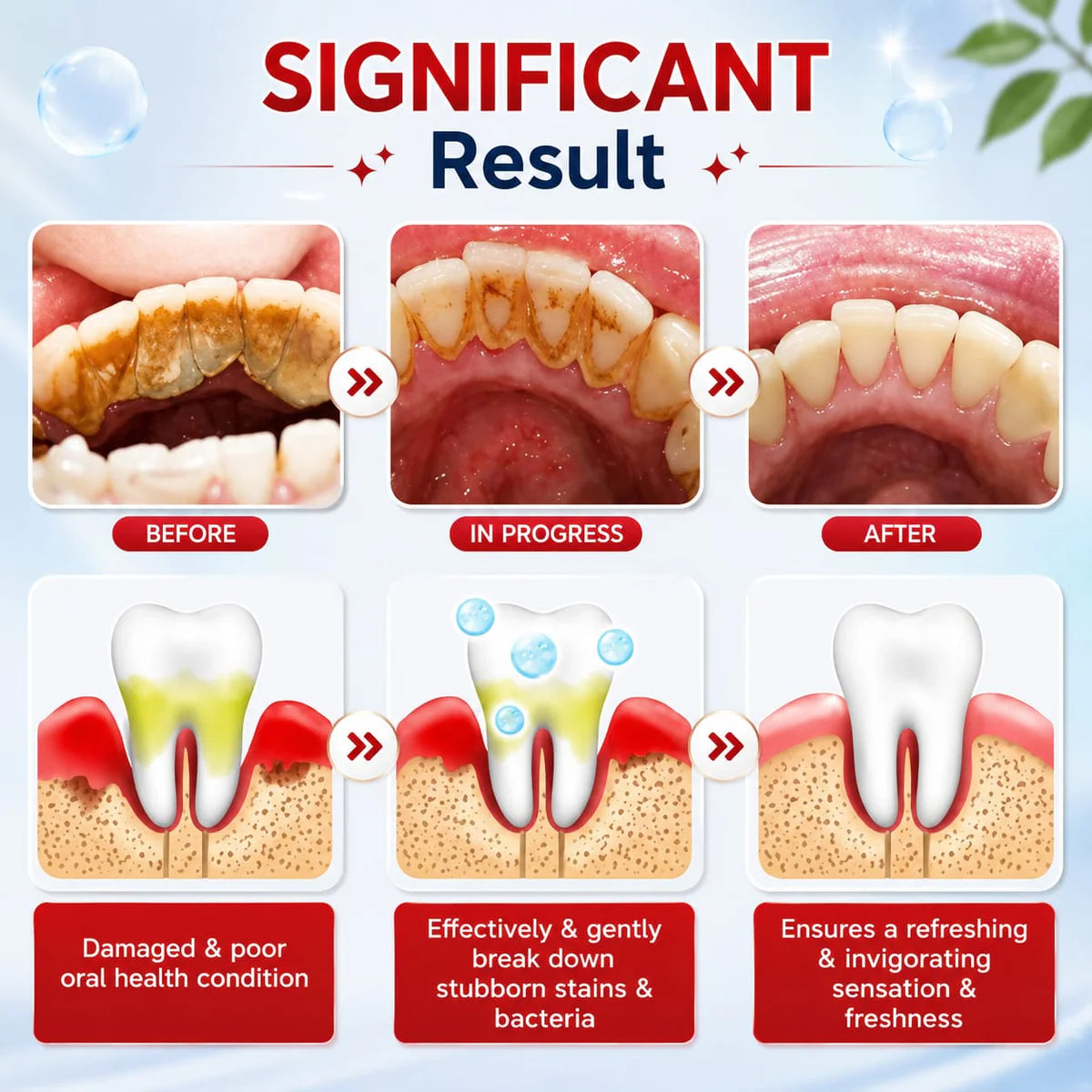 Sp-4 probiotic whitening toothpaste, Teeth Whitener Toothpaste, Natural Tooth Whitener (PACK OF 2)