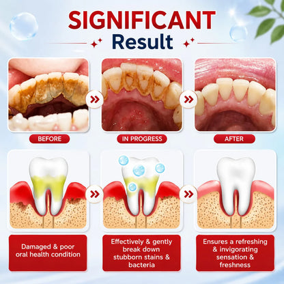 Sp-4 probiotic whitening toothpaste, Teeth Whitener Toothpaste, Natural Tooth Whitener (PACK OF 2)